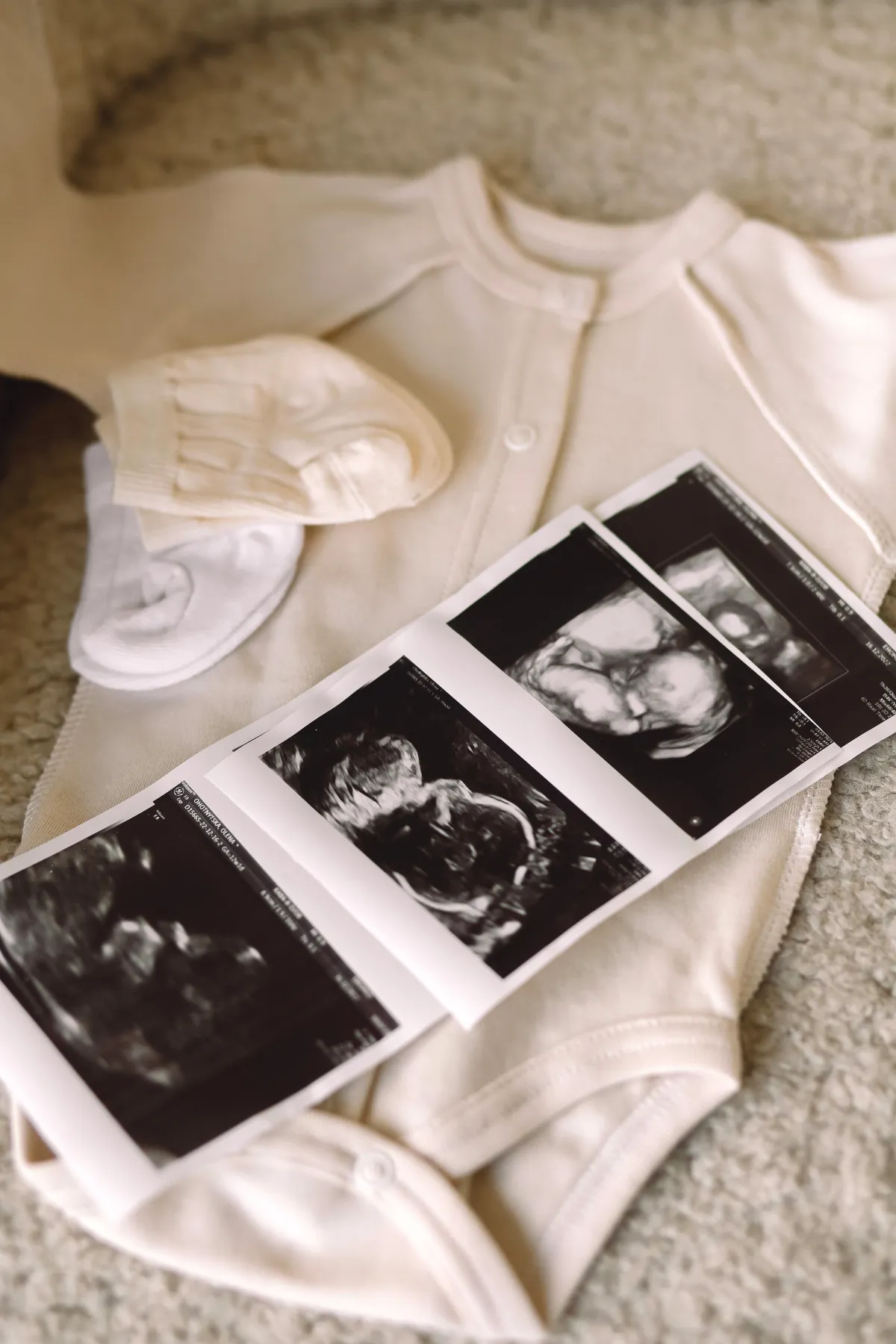 Duelo perinatal - El dolor que la sociedad no ve